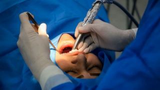 جرم دندان و خونریزی لثه زنگ خطر است