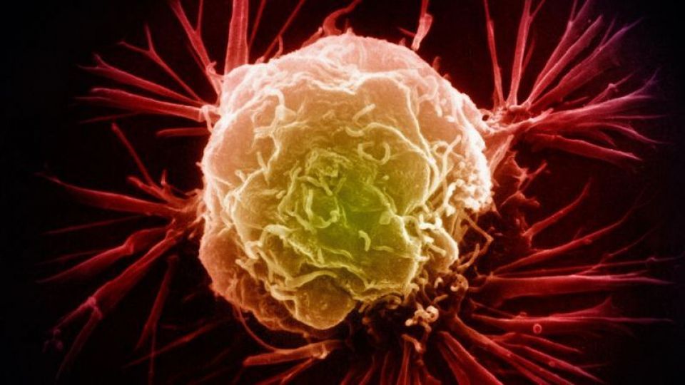 عاملی سرطانزا که شاید به ذهنتان خطور نکند! عاملی سرطانزا که شاید به ذهنتان خطور نکند!