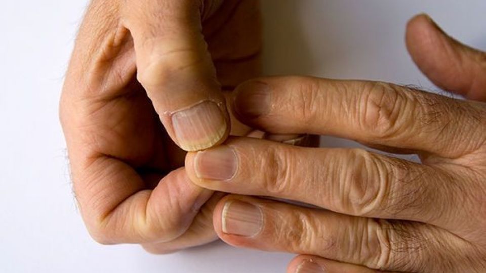 ارتباط شکل ظاهری ناخنها با سلامتی ارتباط شکل ظاهری ناخنها با سلامتی