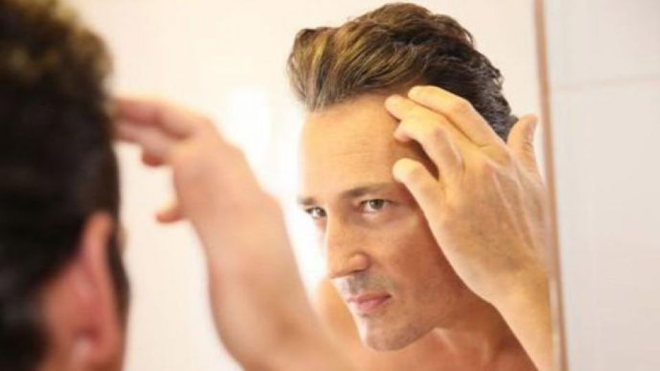 بیماریهایی که باعث ریزش موها میشوند بیماریهایی که باعث ریزش موها میشوند