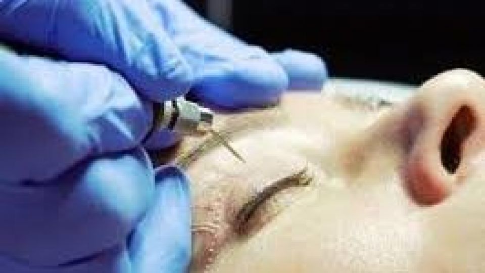 دانستنیهایی درباره جراحی زیبایی پلک دانستنیهایی درباره جراحی زیبایی پلک