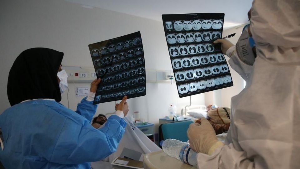 شناسایی ۲۹۸۱ بیمار کرونایی و ثبت ۱۷۹ فوتی جدید در کشور شناسایی ۲۹۸۱ بیمار کرونایی و ثبت ۱۷۹ فوتی جدید در کشور