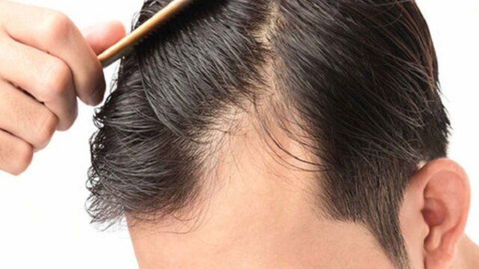 چرا موها میریزند و ریزش چند تار مو در روز طبیعی است؟ چرا موها میریزند و ریزش چند تار مو در روز طبیعی است؟