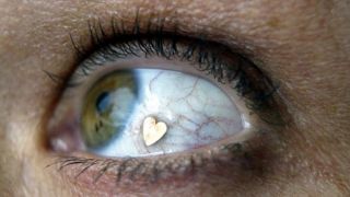 کاشت نگین در چشم؛ عمل لاکچری با ۲۳ میلیون هزینه!