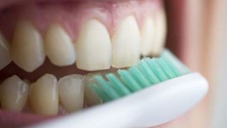 چند راه حل آسان برای رفع زردی دندان‌ها
