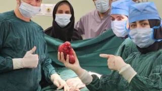 جراحی تومور ۱۴ سانتی از کلیه کودک ۲ ساله 