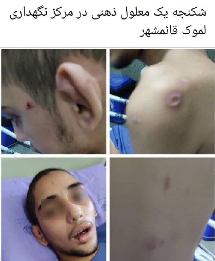 آزار و اذیت یک ناتوان ذهنی در یکی از مراکز نگهداری قائم‌شهر / ورود دستگاه قضا برای شناسایی متهم + تصویر