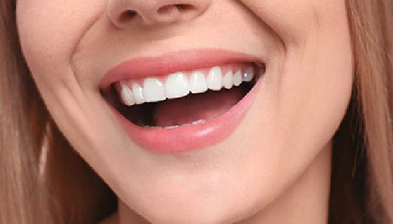 هزینه اصلاح طرح لبخند