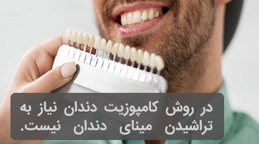 اصلاح طرح لبخند با کامپوزیت ونیر