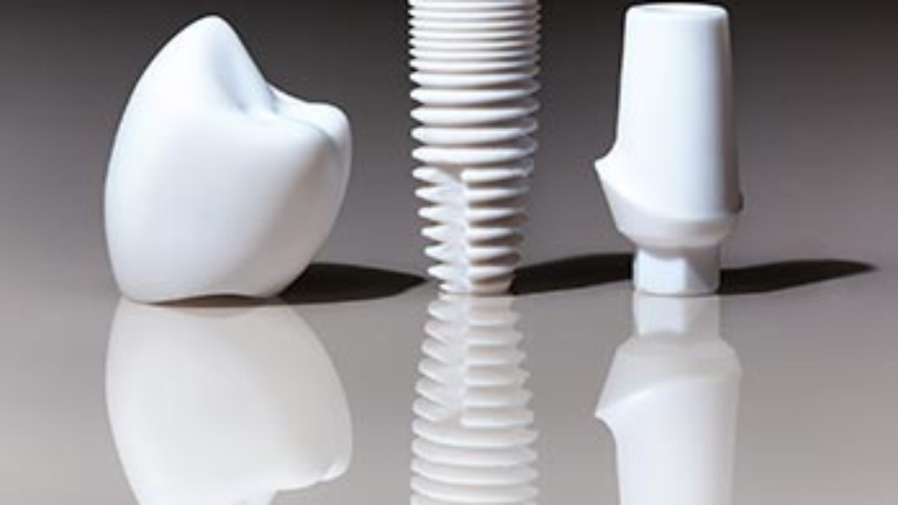 ایمپلنت دندان
