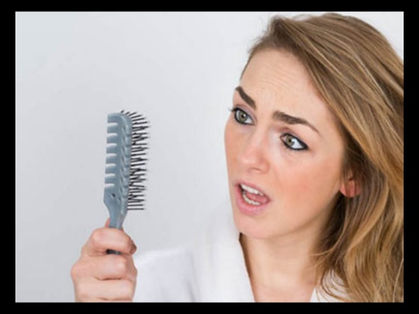 روش های درمانی ریزش مو هورمونی 