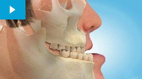 کاربرد عکس دندان در ارتودنسی 