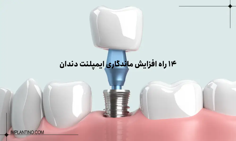 ایمپلنت کاشت شده و متصل کردن اجزای دیگر آن 