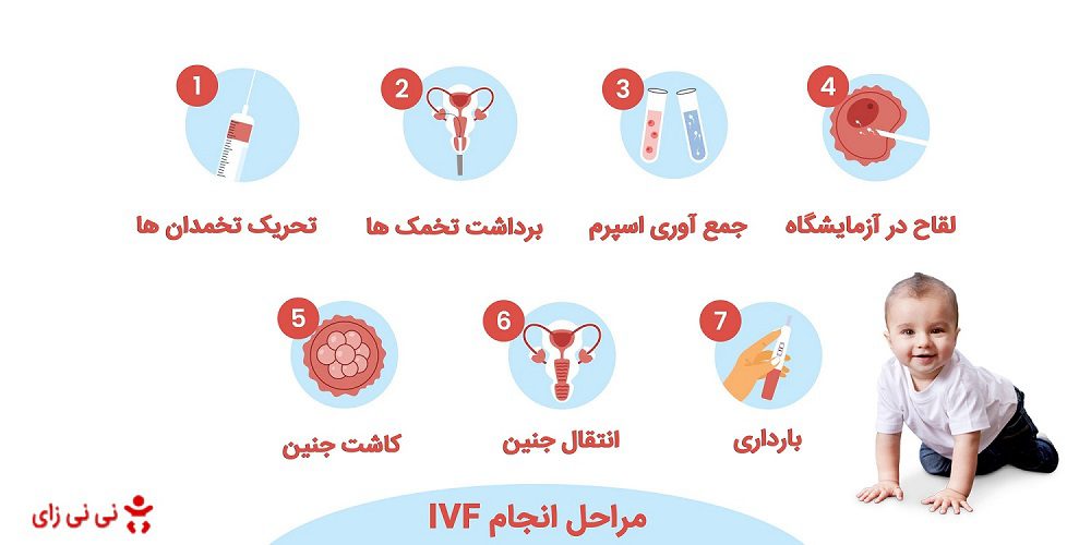 مراحل آی وی اف در ایران