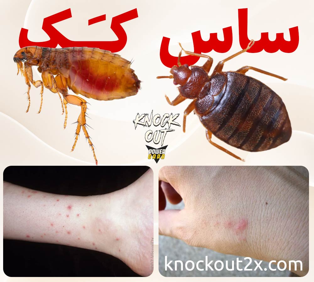 فرق ساس با کک - فرق نیش ساس و کک