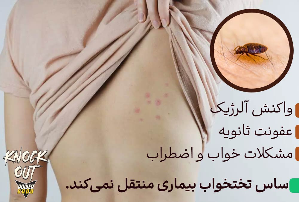 آیا نیش ساس خطرناک است؟ بیماری های ناشی از ساس