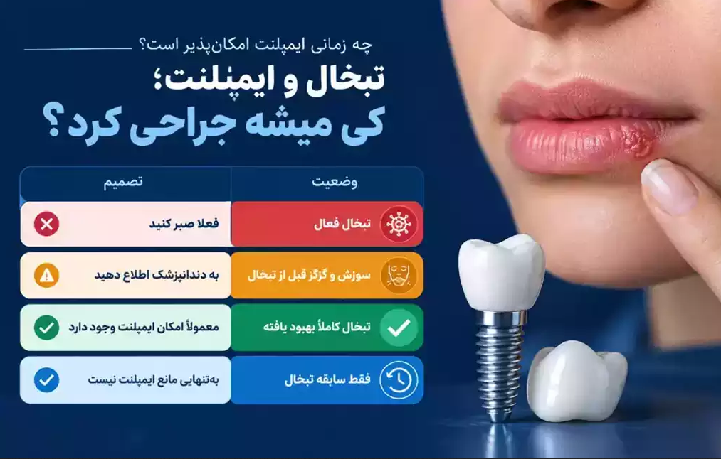 زمان مناسب کاشت ایمپلنت با تبخال فعال، بهبود یافته یا سابقه تبخال