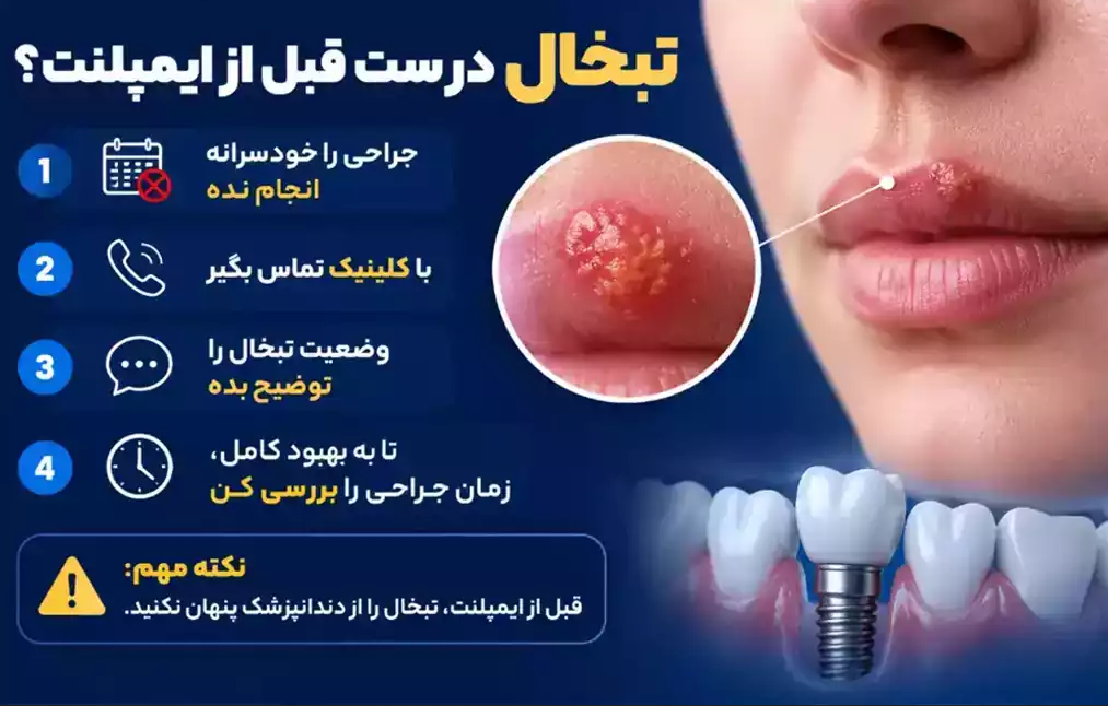 اقدامات لازم در صورت تبخال قبل از ایمپلنت دندان
