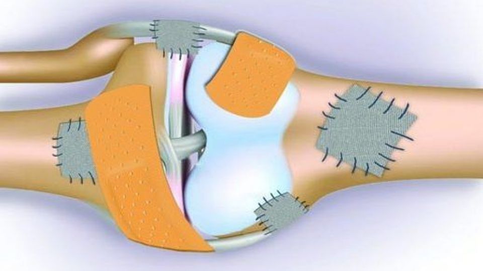 چطور جلوی پوکی استخوان را بگیریم؟ چطور جلوی پوکی استخوان را بگیریم؟