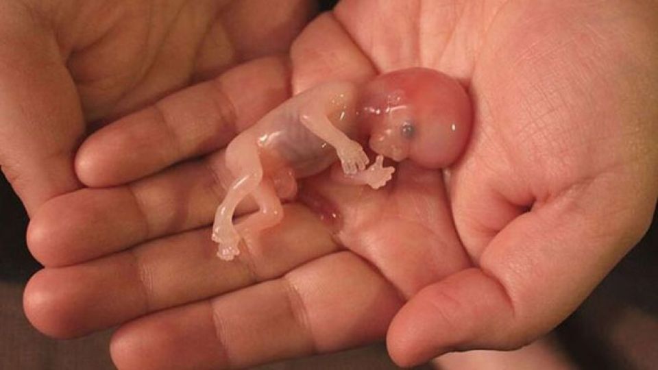 آمارهای تکان‌دهنده سقط جنین در ایران