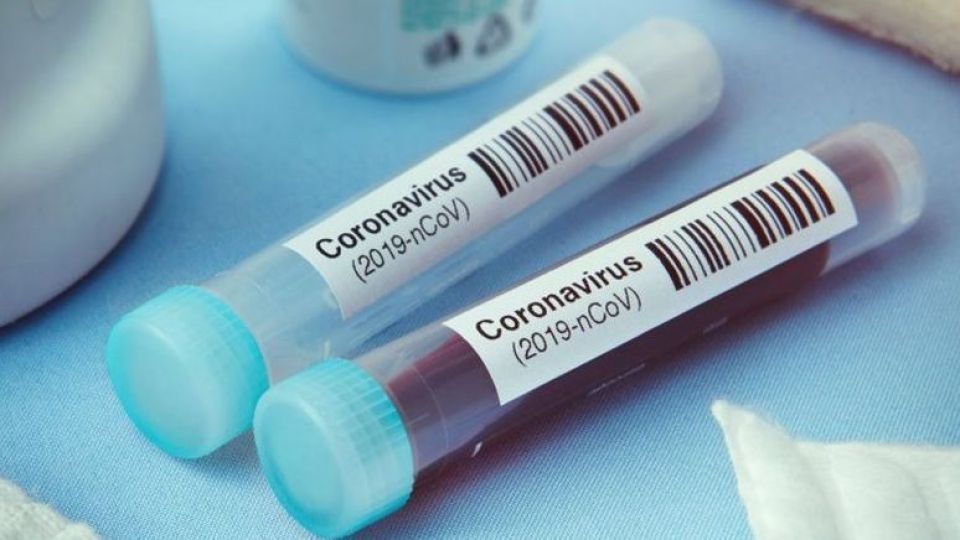 وضعیت کرونا در کشور: خوزستان همچنان در وضعیت قرمز/ ٢٢٨٢ ابتلا و ۵۷ فوتی جدید کرونا وضعیت کرونا در کشور: خوزستان همچنان در وضعیت قرمز/ ٢٢٨٢ ابتلا و ۵۷ فوتی جدید کرونا