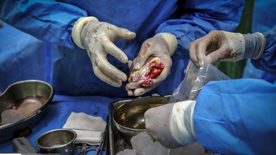 اولین عملیات انتقال قلب در سال ۹۹