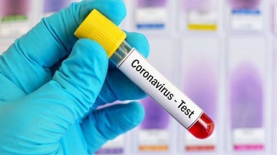 افزایش موارد کرونا در کشور/ شناسایی ۲۹۷۹ بیمار جدید و فوت ۸۱ نفر دیگر/ جهانپور: تمنا میکنیم اصول بهداشتی را جدی بگیرید افزایش موارد کرونا در کشور/ شناسایی ۲۹۷۹ بیمار جدید و فوت ۸۱ نفر دیگر/ جهانپور: تمنا میکنیم اصول بهداشتی را جدی بگیرید