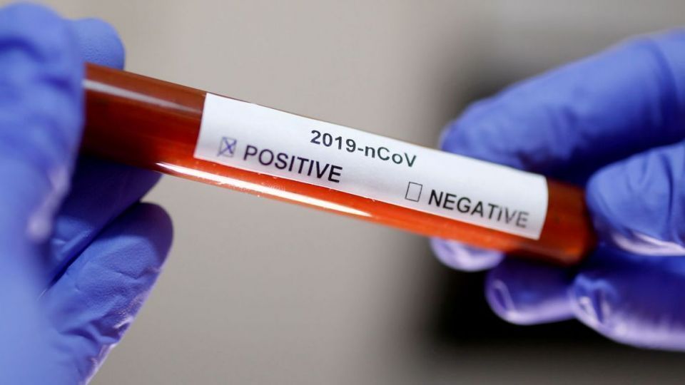 کرونا در ایران: فوتیها سه رقمی شد/ ۲۴۷۲ ابتلای جدید کرونا در ایران: فوتیها سه رقمی شد/ ۲۴۷۲ ابتلای جدید