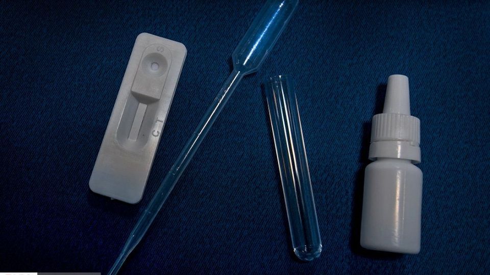 خط تولید کیت تشخیص فوری کرونا