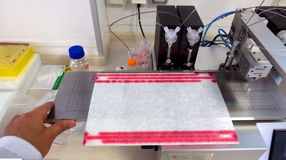 خط تولید کیت تشخیص فوری کرونا