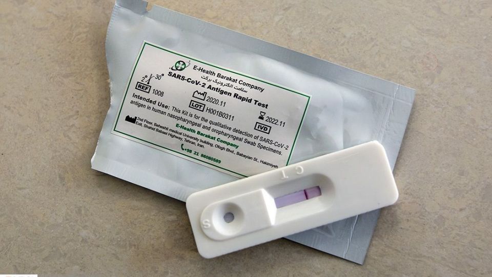 خط تولید کیت تشخیص فوری کرونا