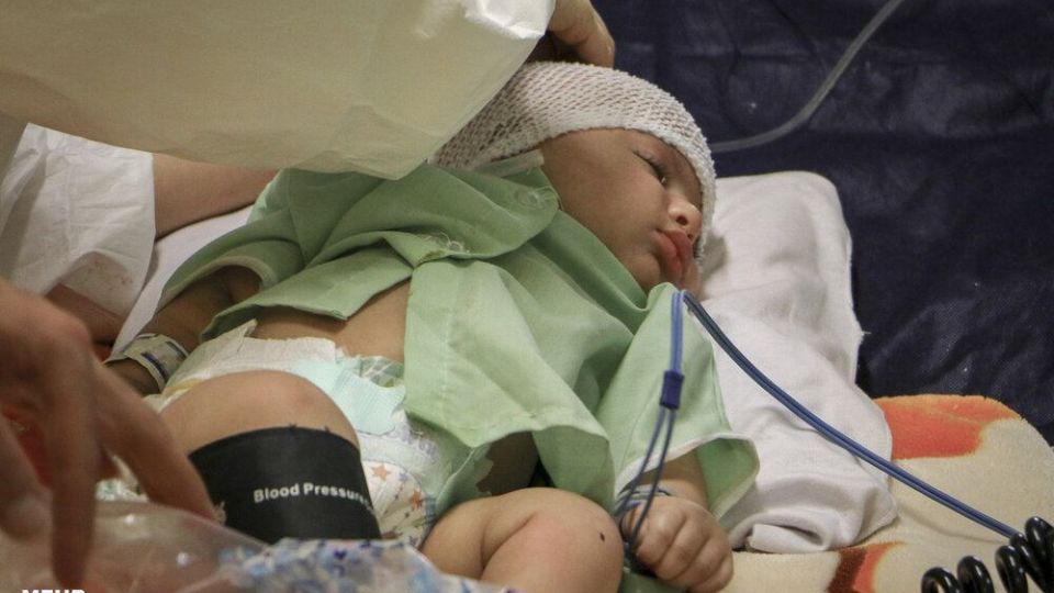  کودکان مبتلا به کرونا