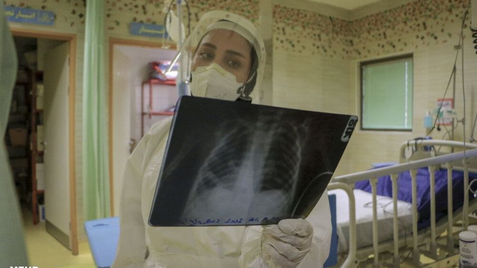  کودکان مبتلا به کرونا