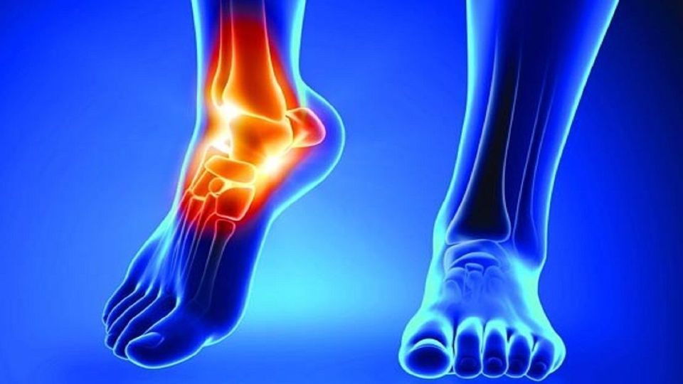 درمان بیماری آرتروز با رژیم غذایی درمان بیماری آرتروز با رژیم غذایی