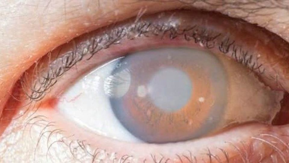 منظور از «تست چشمی» کرونا چیست؟