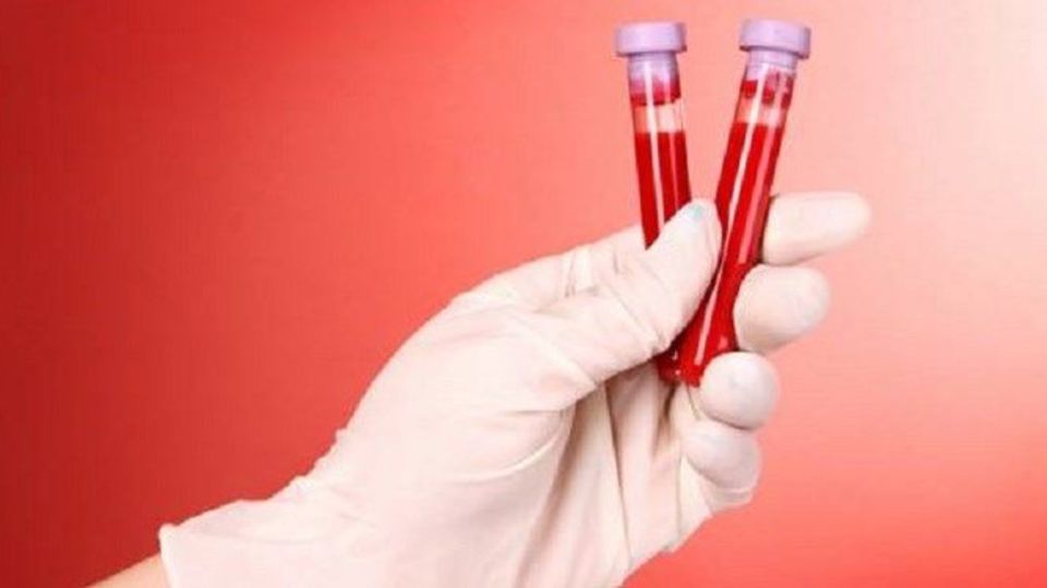 سازمان انتقال خون تهران: اگر خون اهدا نشود، فراخوان ویژه خواهیم داد