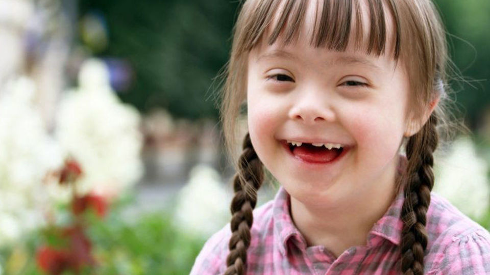 هنر درمانی راهی برای بهتر شدن زندگی مبتلایان «سندروم داون»