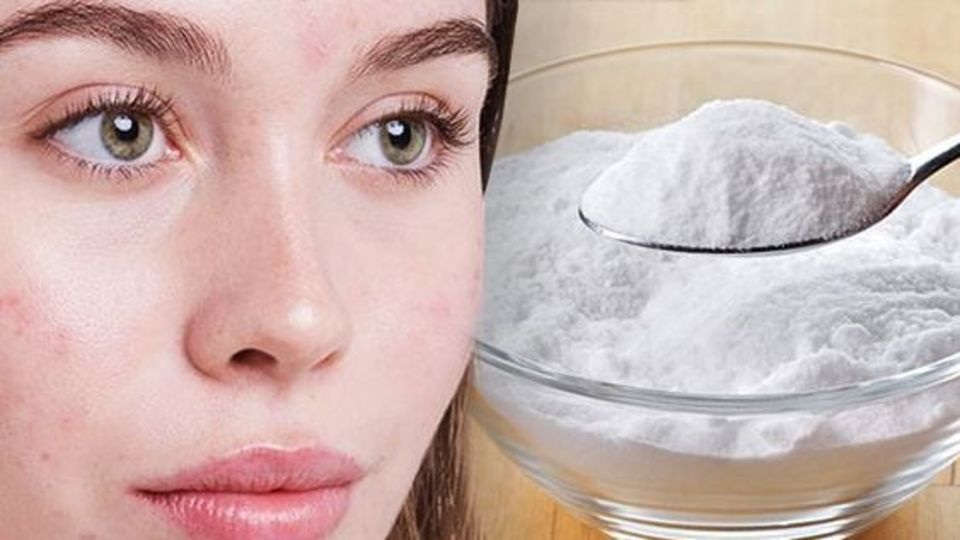 فواید جوش شیرین برای رفع آکنه