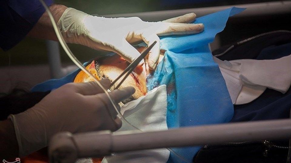 مصدومان حادثه تصادف دانش آموزان در کرمانشاه