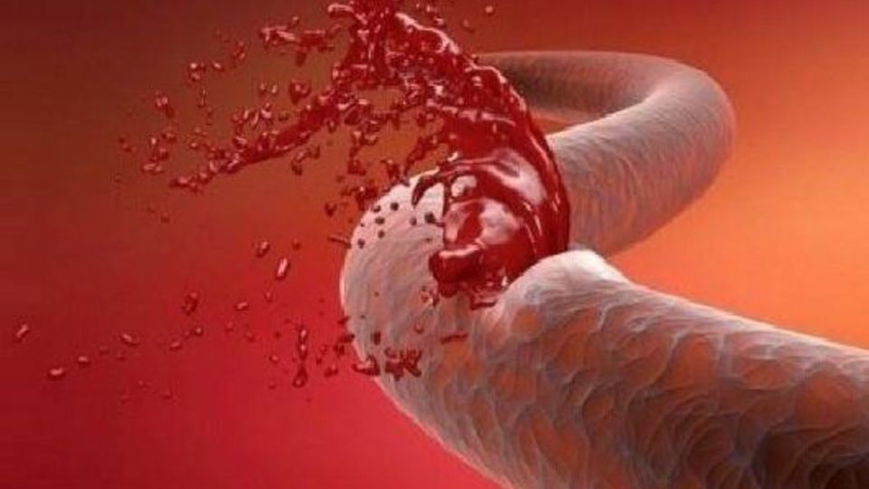 ویتامینی که استرس را از بین می‌برد