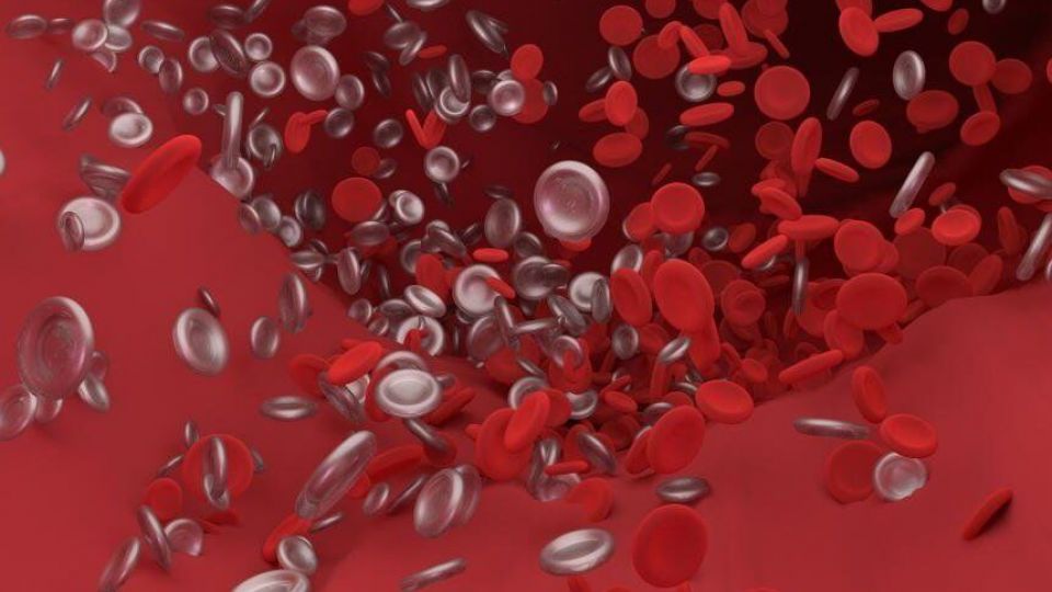 آنتی‌بادی‌های سرکش لخته‌های خون در مبتلایان به کووید-۱۹ ایجاد می‌کند  