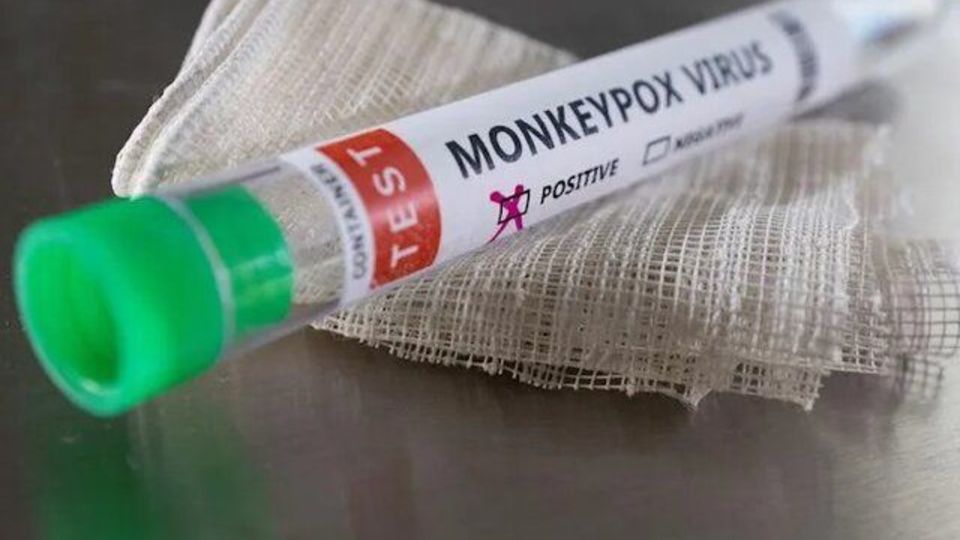 تامین کیت‌های غربالگری آبله میمونی در انستیتو پاستور/توزیع کیت‌های اولیه در آزمایشگاه‌های منتخب