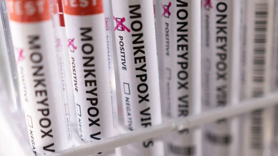 اولین مورد آبله میمون در ایران شناسایی شد