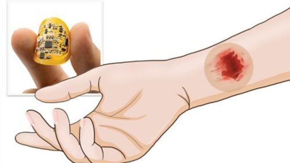 درمان سریعتر زخمها با چسب زخم هوشمند درمان سریعتر زخمها با چسب زخم هوشمند