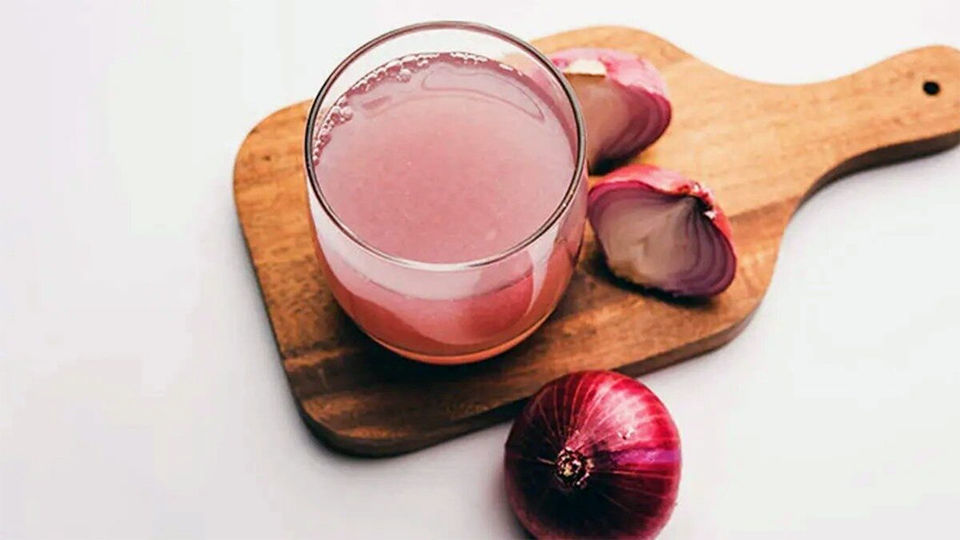 چگونه با آب پیاز موهای سالمتری داشته باشیم؟ چگونه با آب پیاز موهای سالمتری داشته باشیم؟