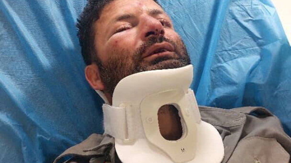 دومین حمله به حافظان طبیعت در شمیرانات؛ این بار ضرب و شتم یک محیط بان دومین حمله به حافظان طبیعت در شمیرانات؛ این بار ضرب و شتم یک محیط بان