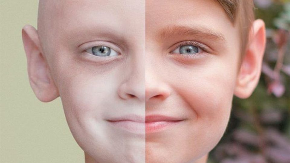 چگونه میتوان «سرطان» را مهار کرد چگونه میتوان «سرطان» را مهار کرد