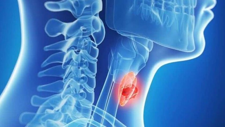 مهمترین بیماریهای غده تیروئید را بشناسید مهمترین بیماریهای غده تیروئید را بشناسید