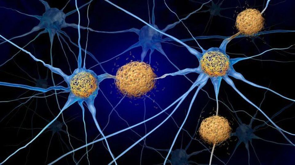کشف راهی جدید برای مقابله با آلزایمر کشف راهی جدید برای مقابله با آلزایمر