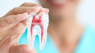 تنها ۱۴ خدمت دندانپزشکی تحت پوشش بیمه است/ دلیل افزایش قیمت خدمات دندانپزشکی چیست؟